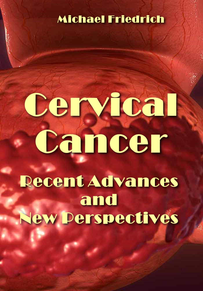 "Cervical Cancer: Recent Advances and New Perspectives" ed.