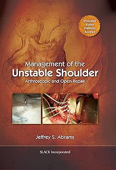 Management of the Unstable Shoulder: Arthroscopic and Open Repair