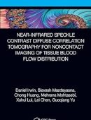 Near-infrared Speckle Contrast Diffuse Correlation Tomography for Noncontact Imaging of Tissue Blood Flow Distribution